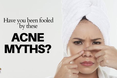 Have you believed in these acne myths? Acne facts